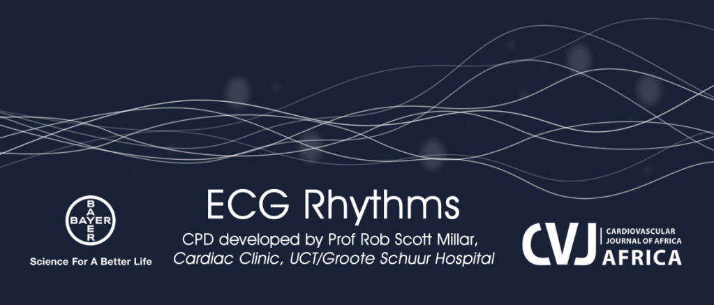 Earn CPD points and ECG Rhythms´ knowledge